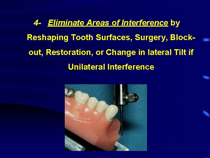 4 - Eliminate Areas of Interference by Reshaping Tooth Surfaces, Surgery, Blockout, Restoration, or