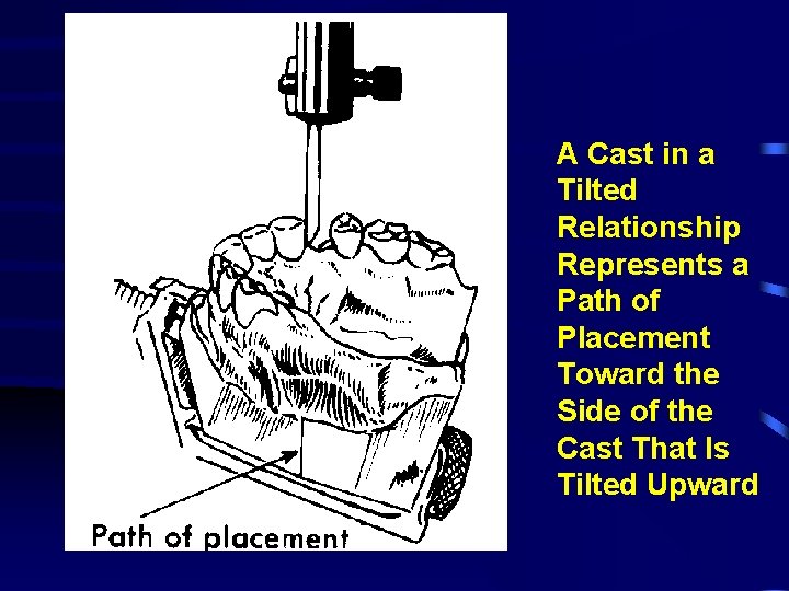 A Cast in a Tilted Relationship Represents a Path of Placement Toward the Side