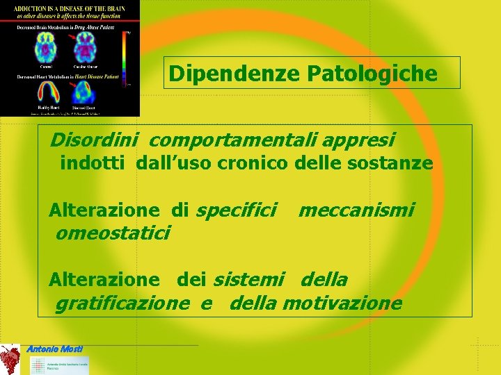 Dipendenze Patologiche Disordini comportamentali appresi indotti dall’uso cronico delle sostanze Alterazione di specifici omeostatici