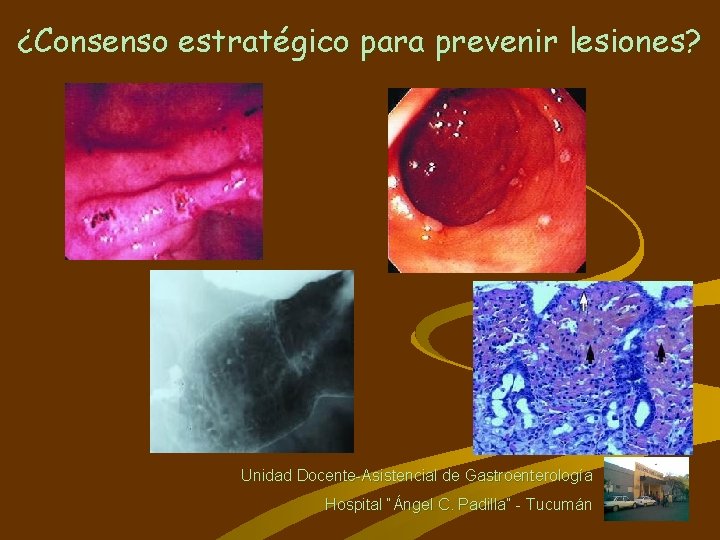 ¿Consenso estratégico para prevenir lesiones? Unidad Docente-Asistencial de Gastroenterología Hospital “Ángel C. Padilla” -