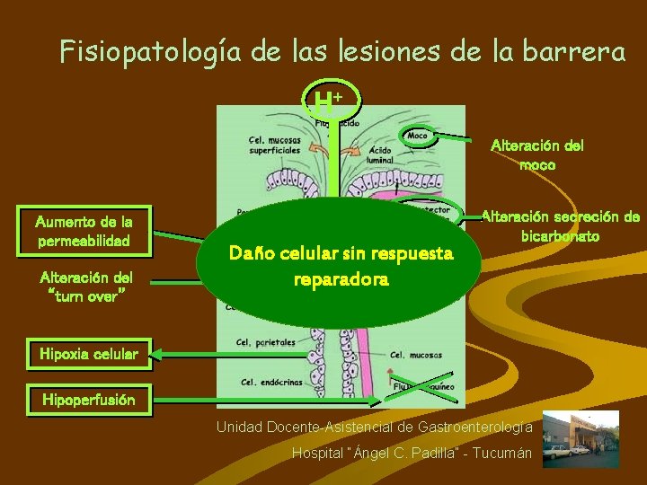 Fisiopatología de las lesiones de la barrera H+ Alteración del moco Aumento de la