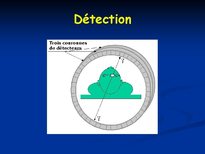 Détection 