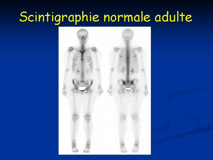 Scintigraphie normale adulte 