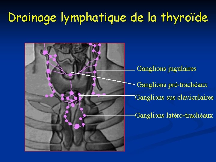 Drainage lymphatique de la thyroïde Ganglions jugulaires Ganglions pré-trachéaux Ganglions sus claviculaires Ganglions latéro-trachéaux Drainage lymphatique de la thyroïde Ganglions jugulaires Ganglions pré-trachéaux Ganglions sus claviculaires Ganglions latéro-trachéaux