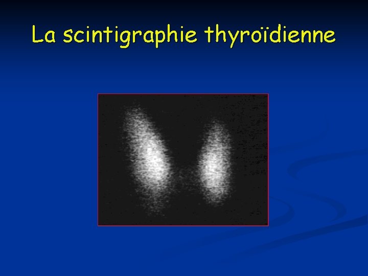 La scintigraphie thyroïdienne 