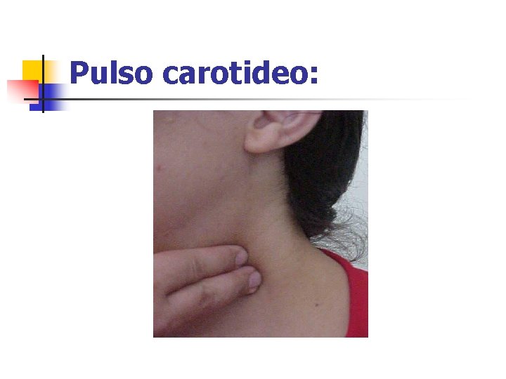 Pulso carotideo: 