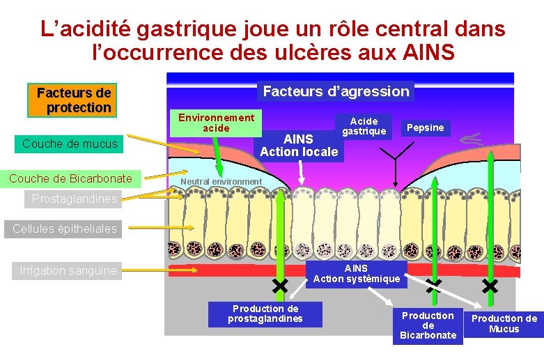 L’acidité gastrique joue un rôle central dans l’occurrence des ulcères aux AINS Facteurs de