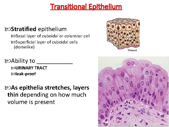 Transitional Epithelium Stratified epithelium Basal layer of cuboidal or columnar cells Superficial layer of