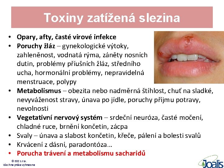 Toxiny zatížená slezina • Opary, afty, časté virové infekce • Poruchy žláz – gynekologické