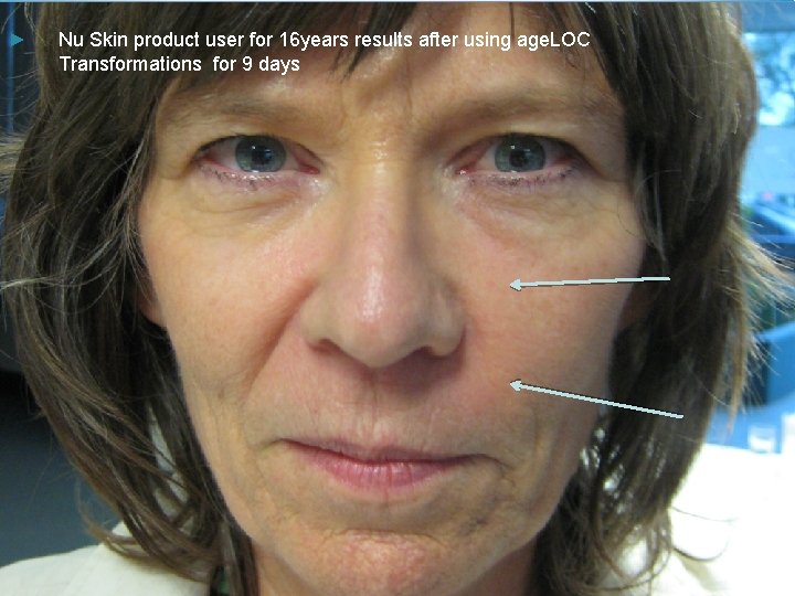 ► Nu Skin product user for 16 years results after using age. LOC Transformations