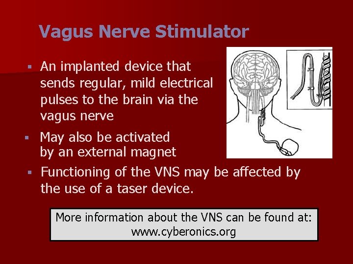 Vagus Nerve Stimulator § An implanted device that sends regular, mild electrical pulses to