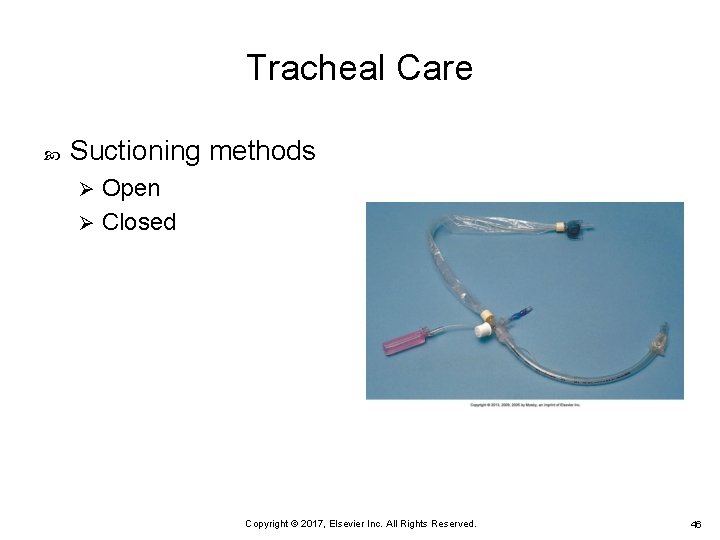 Tracheal Care Suctioning methods Open Ø Closed Ø Copyright © 2017, Elsevier Inc. All