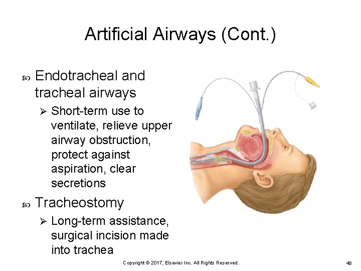 Artificial Airways (Cont. ) Endotracheal and tracheal airways Ø Short-term use to ventilate, relieve