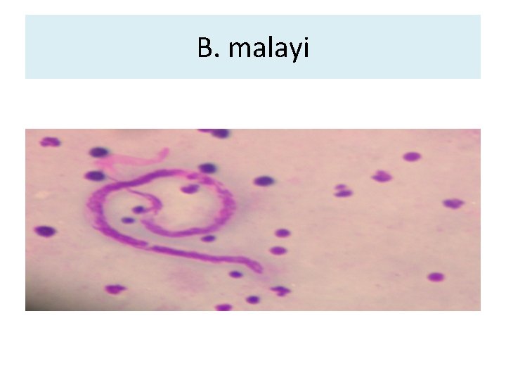 B. malayi B. malayi