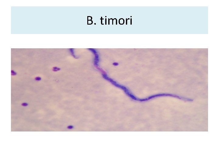 B. timori B. timori