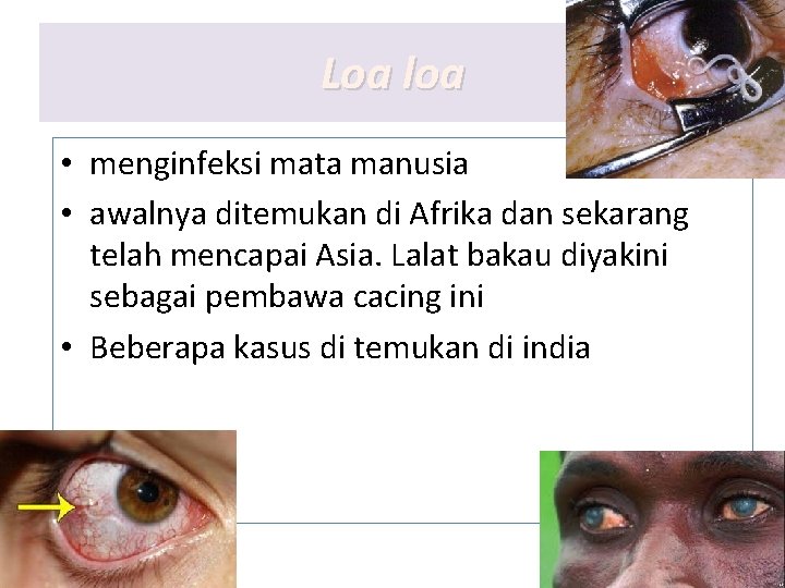 Loa loa • menginfeksi mata manusia • awalnya ditemukan di Afrika dan sekarang telah Loa loa • menginfeksi mata manusia • awalnya ditemukan di Afrika dan sekarang telah