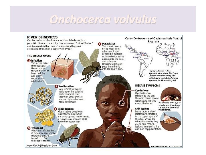 Onchocerca volvulus Onchocerca volvulus
