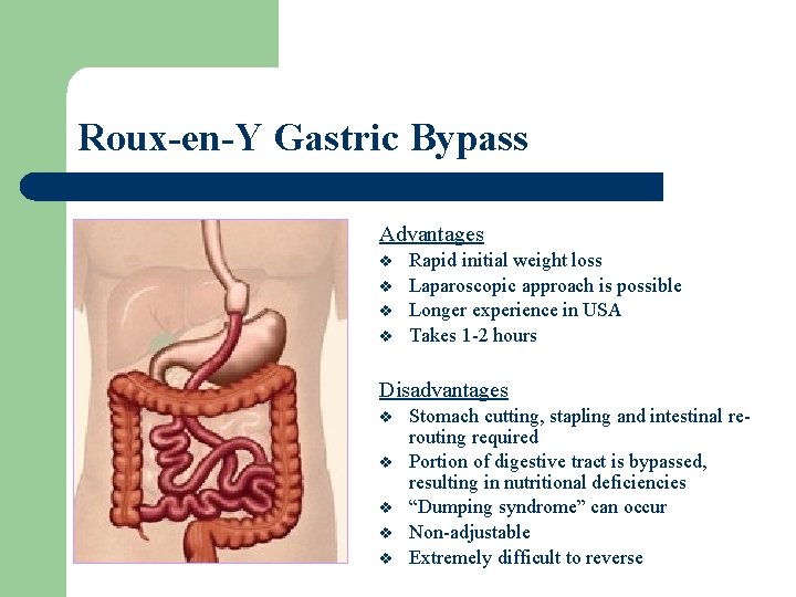 Roux-en-Y Gastric Bypass Advantages v v Rapid initial weight loss Laparoscopic approach is possible