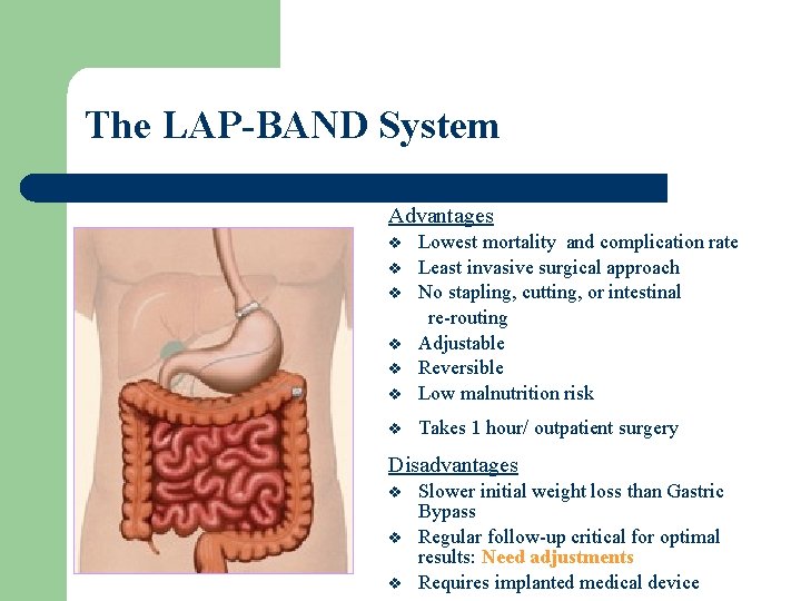 The LAP-BAND System Advantages v Lowest mortality and complication rate Least invasive surgical approach