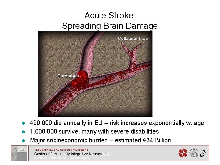 Acute Stroke: Spreading Brain Damage l l l 490. 000 die annually in EU