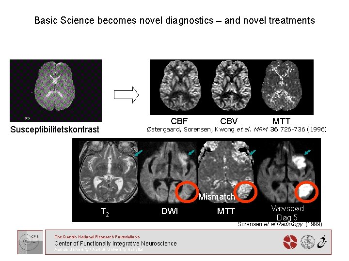 Basic Science becomes novel diagnostics – and novel treatments CBF Susceptibilitetskontrast CBV MTT Østergaard,