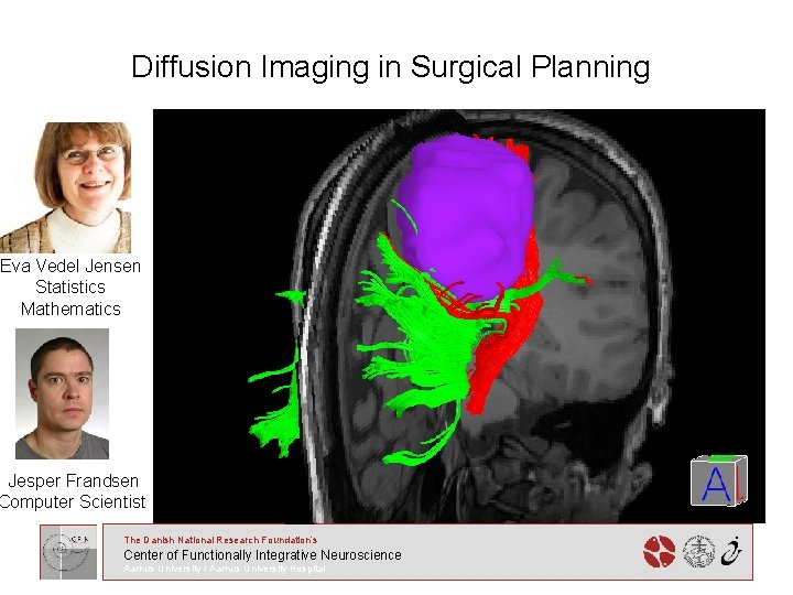 Diffusion Imaging in Surgical Planning Eva Vedel Jensen Statistics Mathematics Jesper Frandsen Computer Scientist