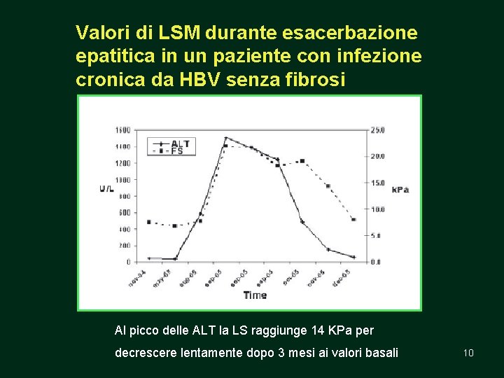 Valori di LSM durante esacerbazione epatitica in un paziente con infezione cronica da HBV