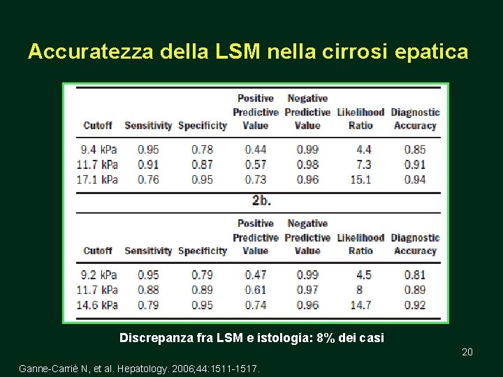 Accuratezza della LSM nella cirrosi epatica Discrepanza fra LSM e istologia: 8% dei casi