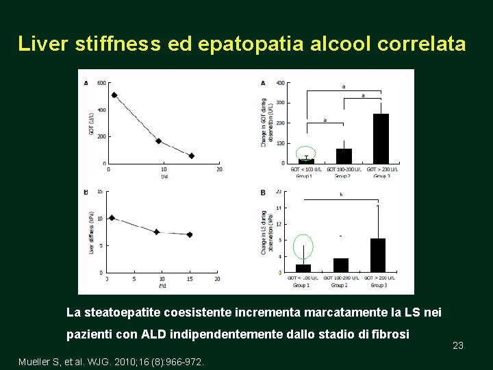 Liver stiffness ed epatopatia alcool correlata La steatoepatite coesistente incrementa marcatamente la LS nei