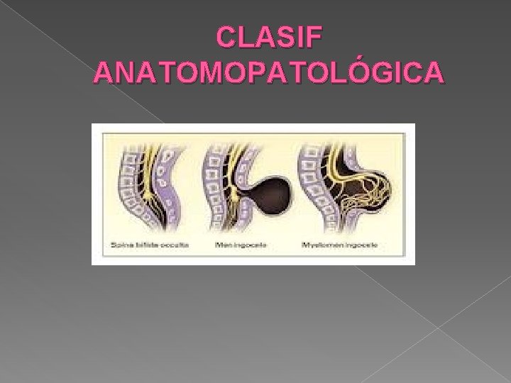 CLASIF ANATOMOPATOLÓGICA CLASIF ANATOMOPATOLÓGICA