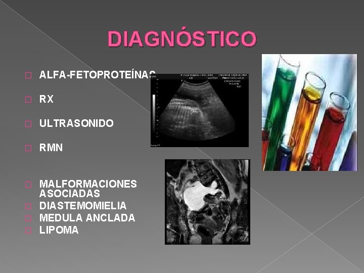 DIAGNÓSTICO � ALFA-FETOPROTEÍNAS � RX � ULTRASONIDO � RMN MALFORMACIONES ASOCIADAS � DIASTEMOMIELIA � DIAGNÓSTICO � ALFA-FETOPROTEÍNAS � RX � ULTRASONIDO � RMN MALFORMACIONES ASOCIADAS � DIASTEMOMIELIA �