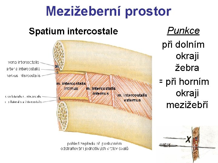 Mezižeberní prostor Punkce při dolním okraji žebra = při horním okraji mezižebří 