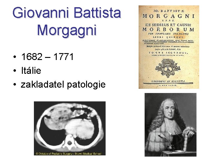 Giovanni Battista Morgagni • 1682 – 1771 • Itálie • zakladatel patologie 