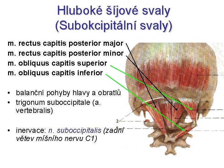 Hluboké šíjové svaly (Subokcipitální svaly) m. rectus capitis posterior major m. rectus capitis posterior