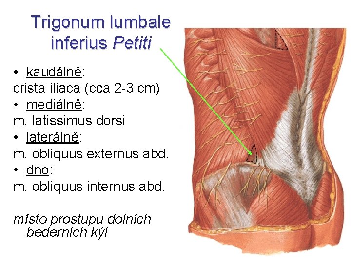 Trigonum lumbale inferius Petiti • kaudálně: crista iliaca (cca 2 -3 cm) • mediálně: