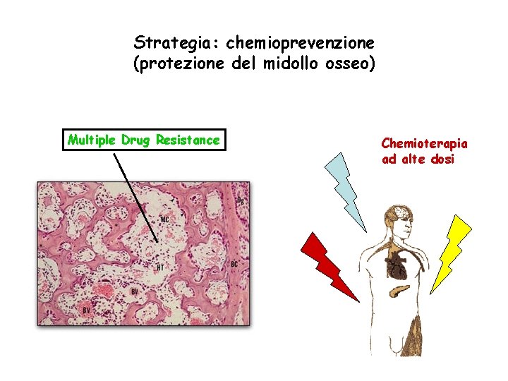 Strategia: chemioprevenzione (protezione del midollo osseo) Multiple Drug Resistance Chemioterapia ad alte dosi 