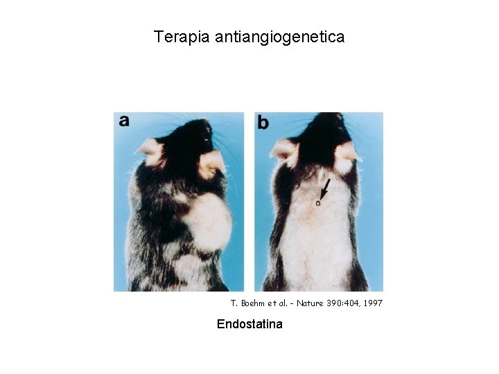 Terapia antiangiogenetica T. Boehm et al. - Nature 390: 404, 1997 Endostatina Terapia antiangiogenetica T. Boehm et al. - Nature 390: 404, 1997 Endostatina