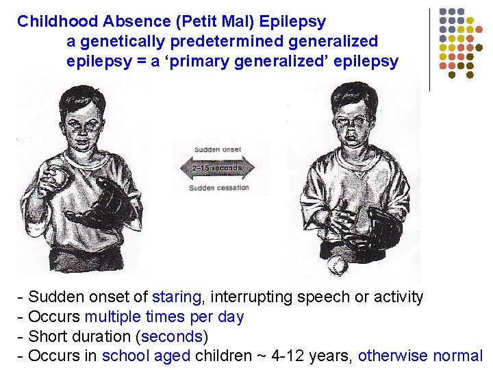 Childhood Absence (Petit Mal) Epilepsy a genetically predetermined generalized epilepsy = a ‘primary generalized’