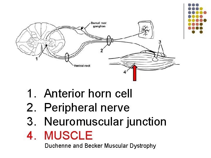 skin 1. 2. 3. 4. Anterior horn cell Peripheral nerve Neuromuscular junction MUSCLE Duchenne