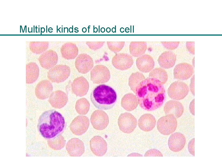 Multiple kinds of blood cell 
