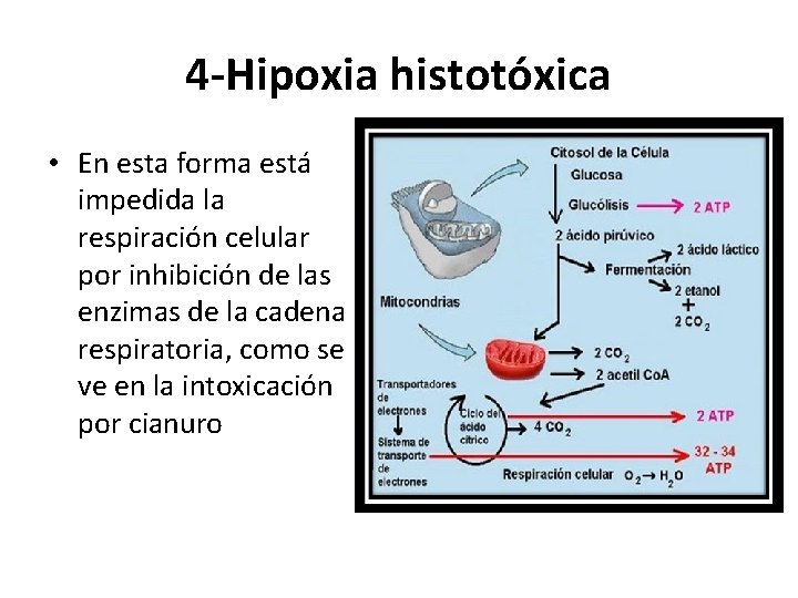 4 -Hipoxia histotóxica • En esta forma está impedida la respiración celular por inhibición