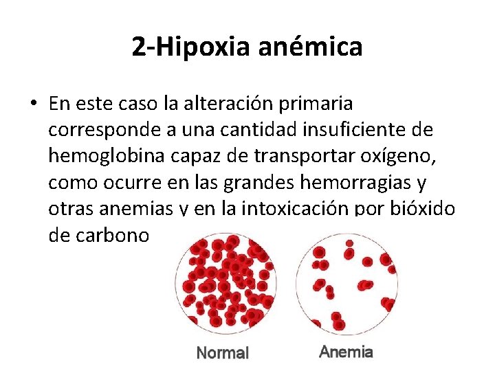 2 -Hipoxia anémica • En este caso la alteración primaria corresponde a una cantidad