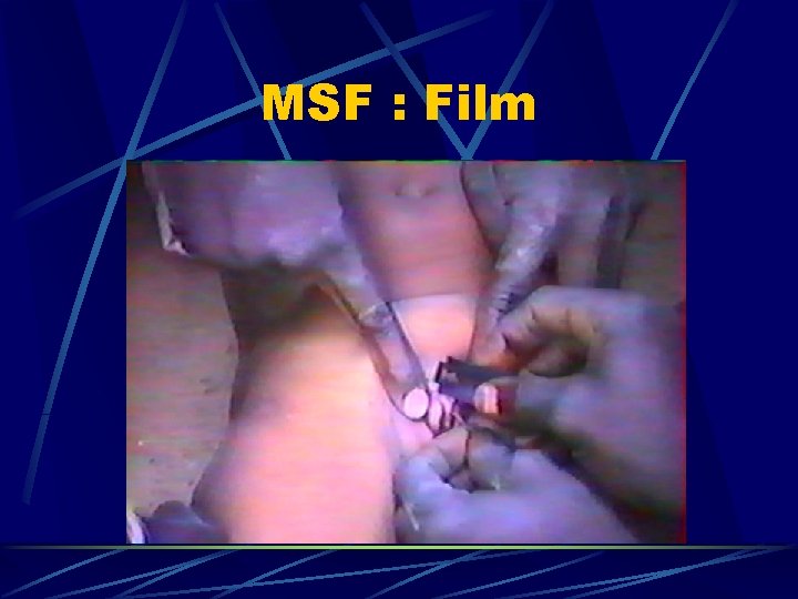 MSF : Film 