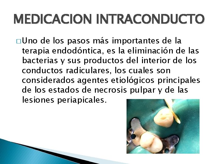 MEDICACION INTRACONDUCTO � Uno de los pasos más importantes de la terapia endodóntica, es