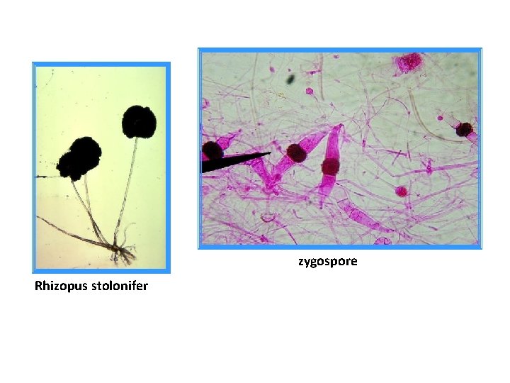 zygospore Rhizopus stolonifer 