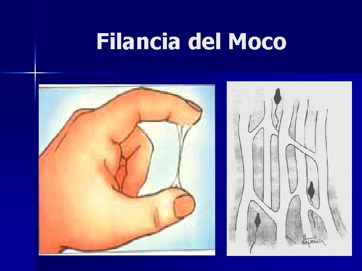 Filancia del Moco 