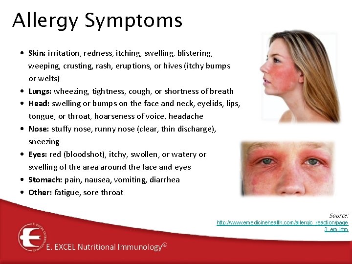 Allergy Symptoms • Skin: irritation, redness, itching, swelling, blistering, weeping, crusting, rash, eruptions, or Allergy Symptoms • Skin: irritation, redness, itching, swelling, blistering, weeping, crusting, rash, eruptions, or