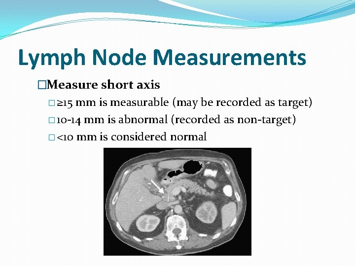Lymph Node Measurements �Measure short axis � ≥ 15 mm is measurable (may be