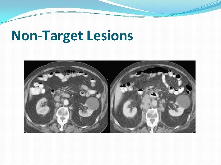 Non-Target Lesions 