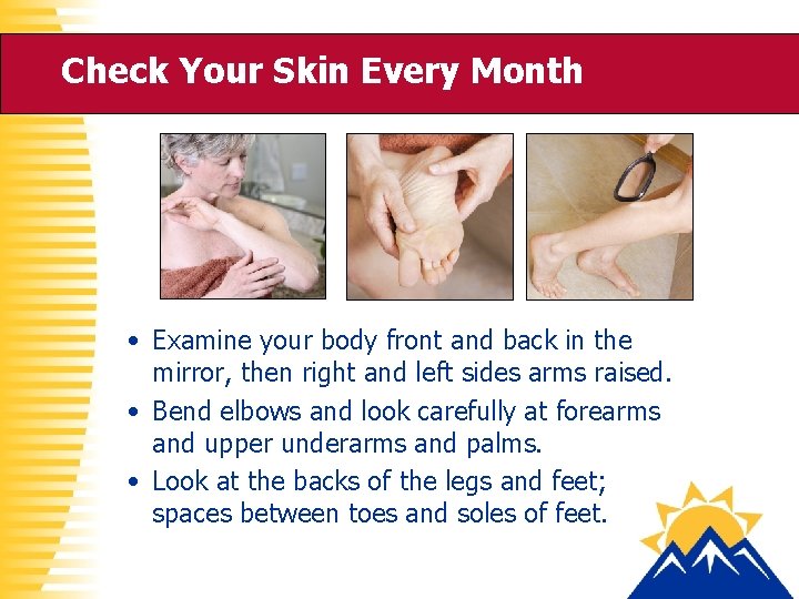 Check Your Skin Every Month • Examine your body front and back in the